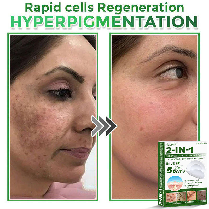 🚚70%off Hudros® 2-in-1 Microneedle & Hydrocolloid Patch | Raised Moles,Acne,  Flat Warts & Skin Tags Remover | Improves Wrinkles, Scars & Blemishes | Invisible Star Pimple Patches for Face & Body | 144 Count