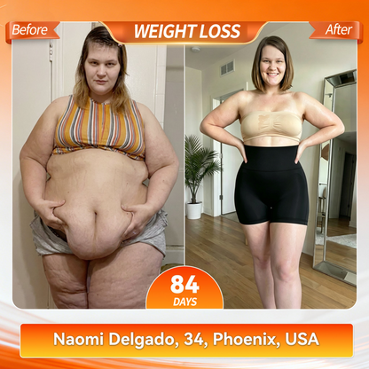 𝐎𝐟𝐟𝐢𝐜𝐢𝐚𝐥 𝐁𝐫𝐚𝐧𝐝 𝐒𝐭𝐨𝐫𝐞 | 🍒 LUCKYSONG® 2026 8-in-1  Thermo Fat-Burning & Butt-Lifting Yoga Slimming Pants